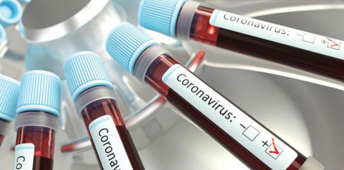 New daily coronavirus cases rise above 700 in the UAE